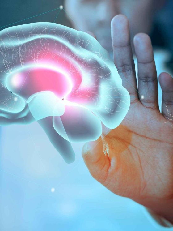 Comparing Stroke vs. Brain Aneurysm